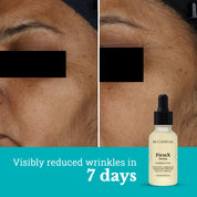 FirmX Serum with Niacinamide & Advanced Peptide | Anti Wrinkle Serum