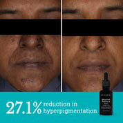 Blemish Balance Serum | For Menopausal Skin