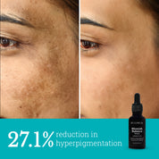 Blemish Balance Serum | For Menopausal Skin