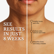 Neck Repair Skin Tightening Night Cream