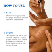 Blemish Balance Serum | Reduces Hyperpigmentation and Acne Marks