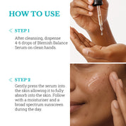 Blemish Balance Serum | For Menopausal Skin