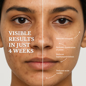 Blemish Balance Serum | For Menopausal Skin